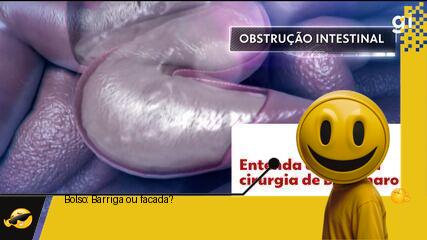 Bolsonaro na faca: a saga do presidente em busca de uma barriga de tanquinho